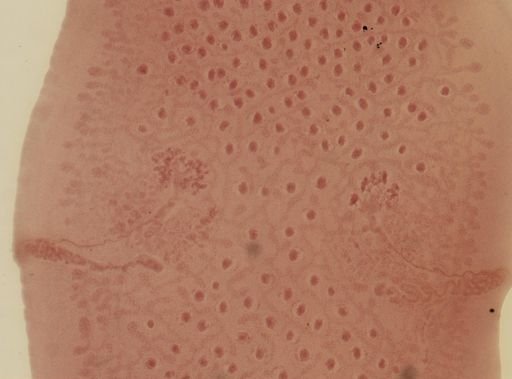 Dipylidium caninum