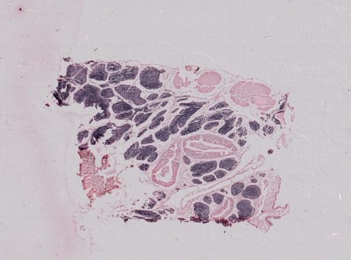 Modiolus
