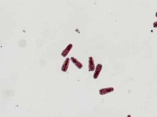 Fasciola hepatica