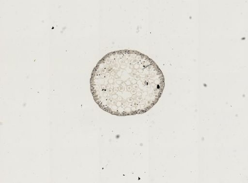 Ascaris