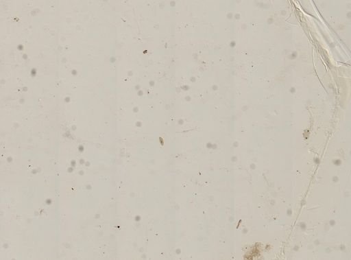 Paramecium