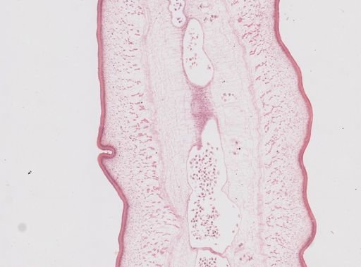 Taenia saginata