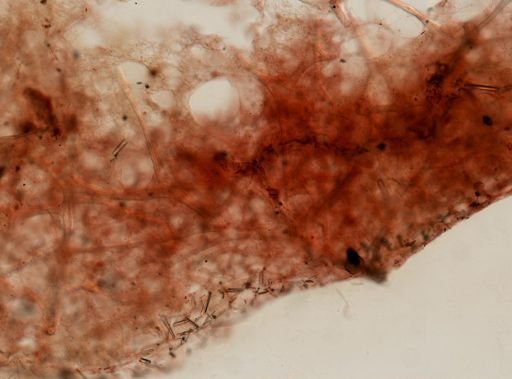 Demospongiae
