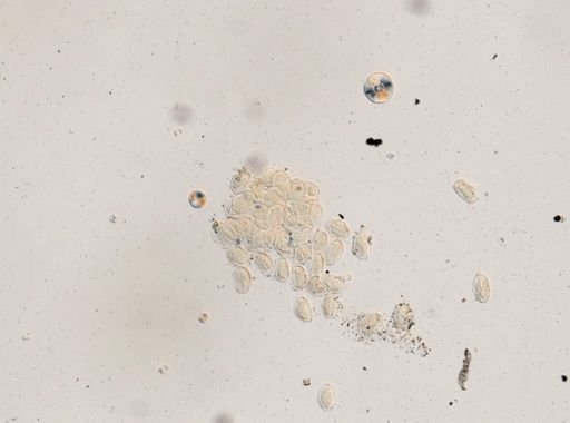 Ascaris lumbricoides