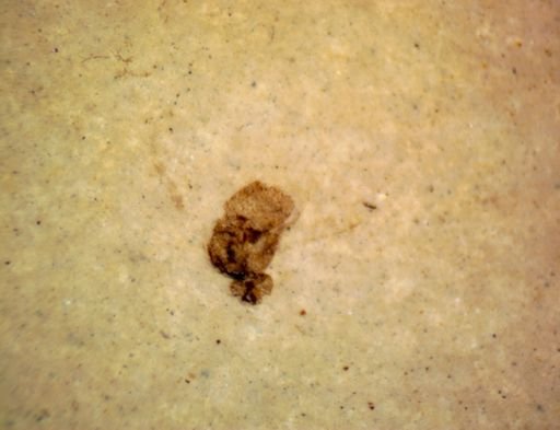 undet. Diptera