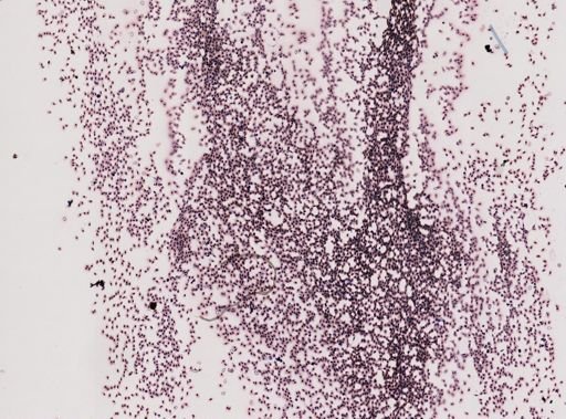 Trypanosoma diemyctyli