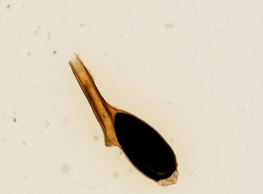 Pthirus pubis