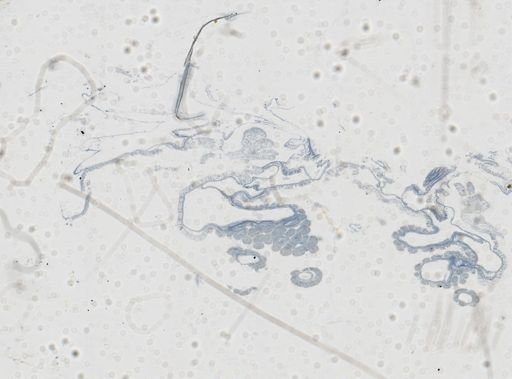 Astrangia poculata