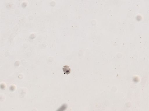 Colpidium