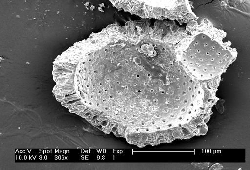 Globigerinoides sacculifer