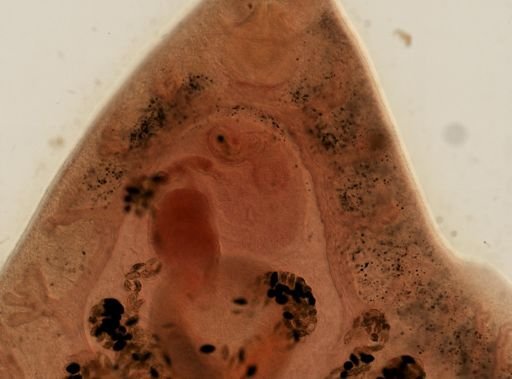 Fasciola hepatica