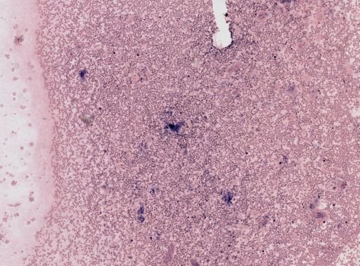 Trypanosoma