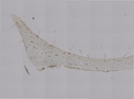 Zoanthus