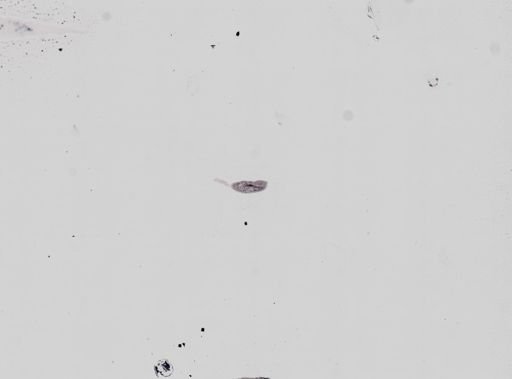 Plagiostomum whitmani