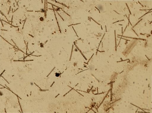 Bacillariophyceae