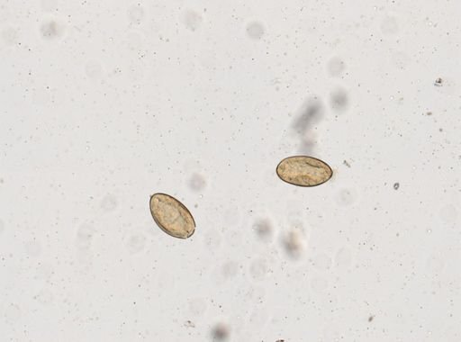 Fasciola hepatica