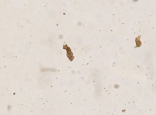 Diphyllobothrium canis