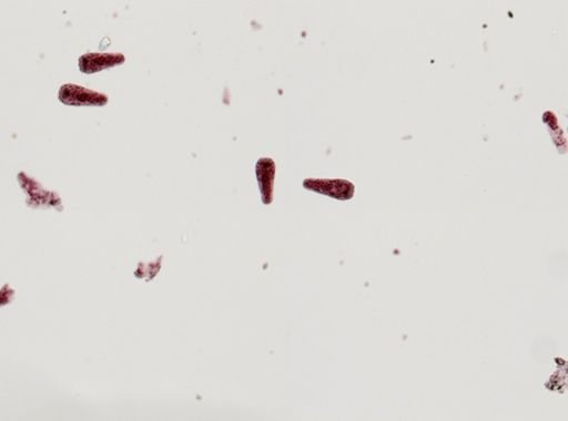 Fasciola hepatica