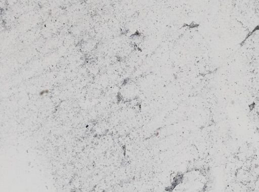 Trichomonas wenrichi