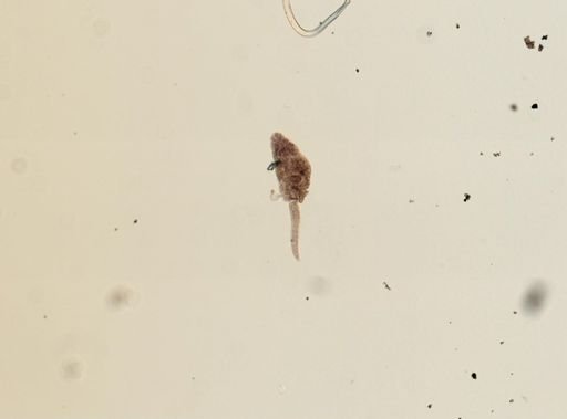Echinostomatidae