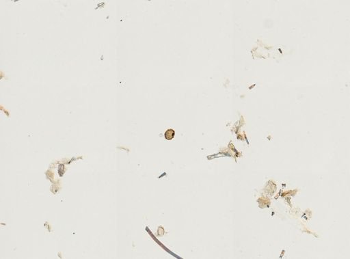 Ascaris lumbricoides