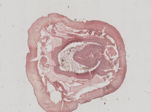 Lumbricus