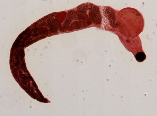 Gorgoderina