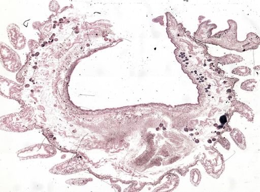 Thysanozoon brocchii