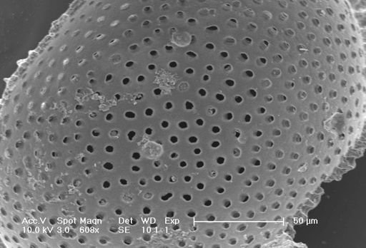 Globigerinella siphonifera