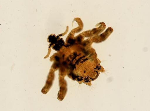 Pthirus pubis