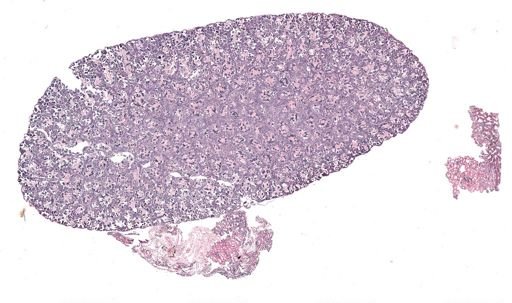 Rana clamitans