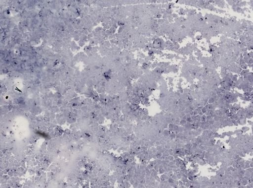 Leishmania donovani