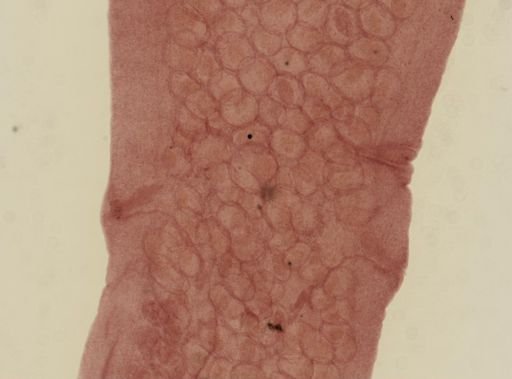 Dipylidium caninum