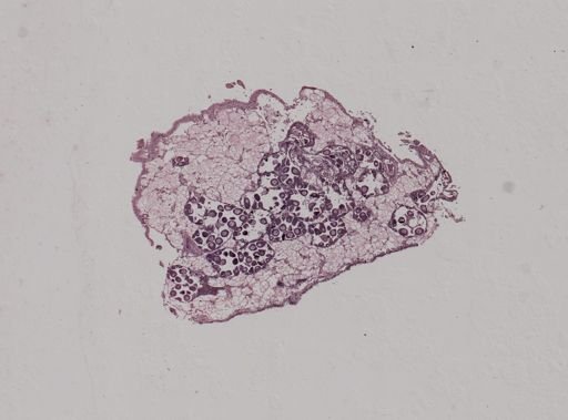 Modiolus