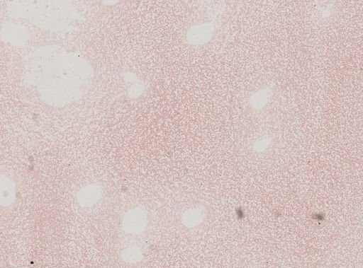 Plasmodium vivax