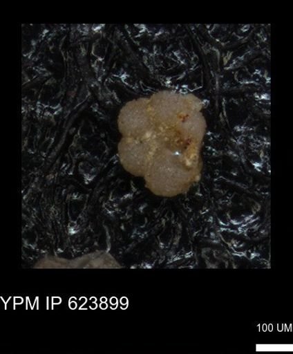 undet. Rugoglobigerinidae