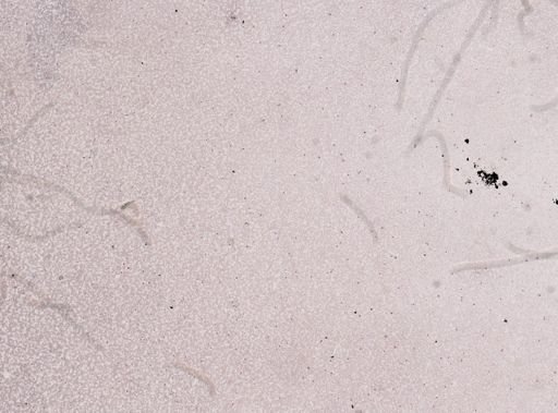 Trypanosoma equinum