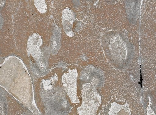 Taenia crassicollis