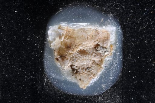 Bryozoa