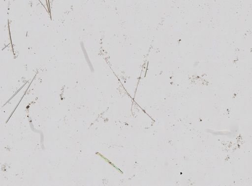 Tetillidae