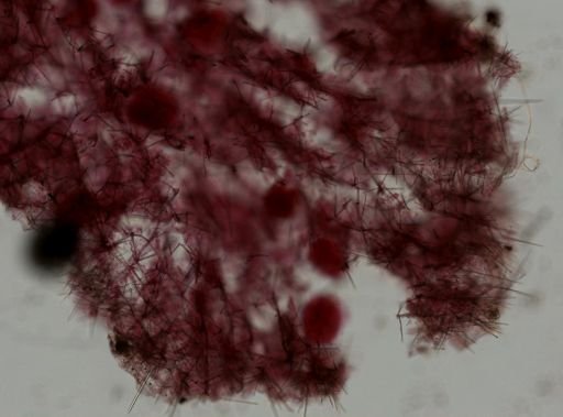Clathria coralloides