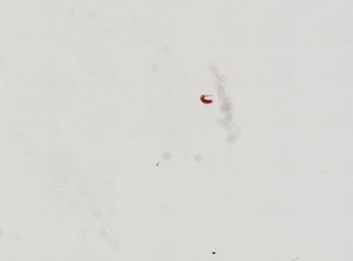Trematoda
