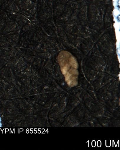 Verneuilina canadensis