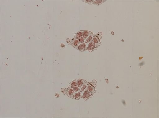 Rhopalosiphum nymphaeae