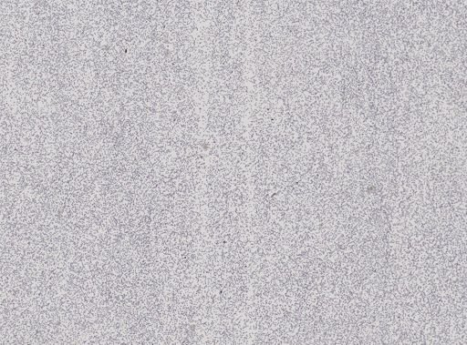 Plasmodium circumflexum