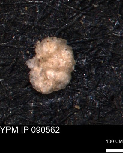 Alveolophragmium linki