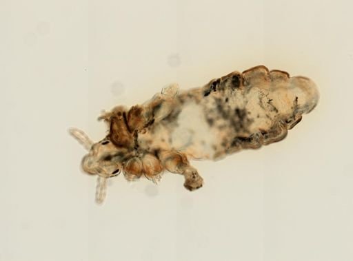 Pediculus humanus