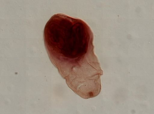 Eucestoda