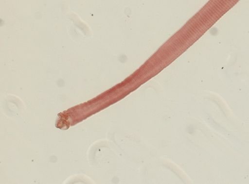 Hymenolepis diminuta