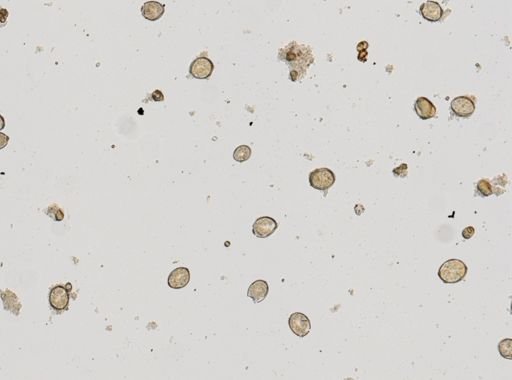 Diphyllobothrium latum